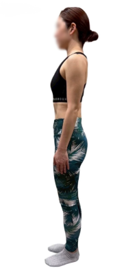 姿勢改善後の画像